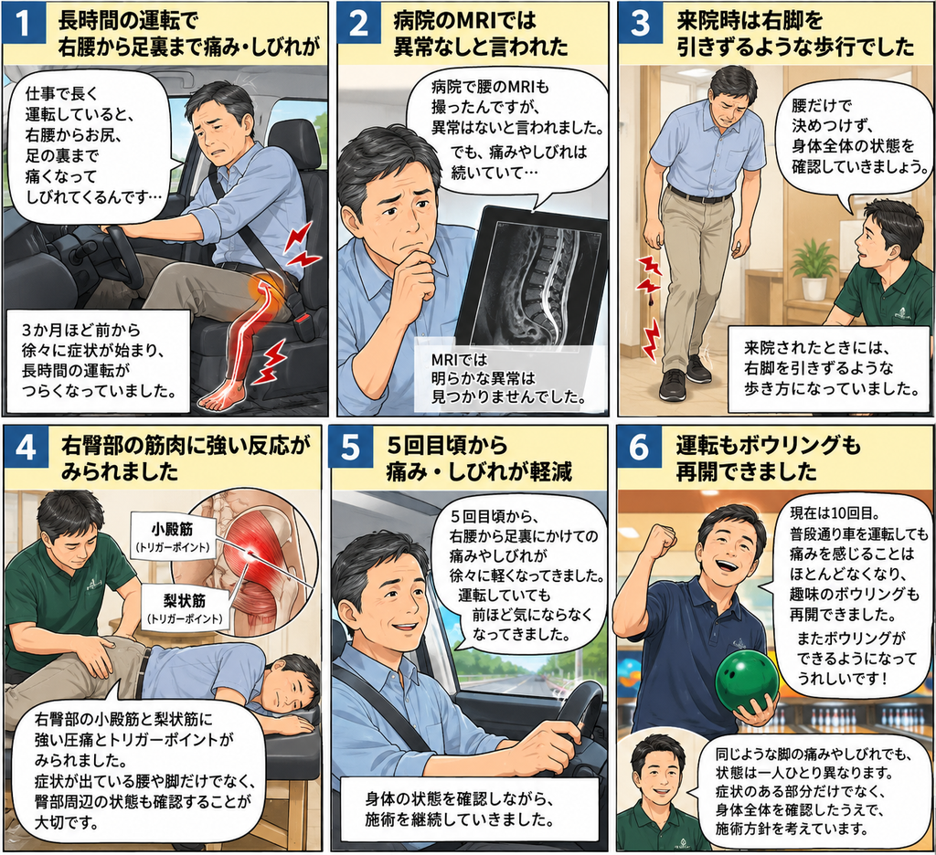 運転すると右腰から足裏まで痛み・しびれが出ていた50代男性の症例｜蒲田・梅屋敷